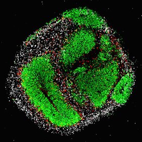 Hirnorganoide, gebildet von humanen embryonalen Stammzellen, sind organähnliche Zellkulturen des menschlichen Gehirns bestehend aus neuralen Stamm- (rün), Vorläufer- (rot) und Nervenzellen (weiss).