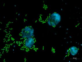 Bakterien der Gattung Pseudomonas produzieren einen stark antimikrobiellen Naturstoff, Keanumycin