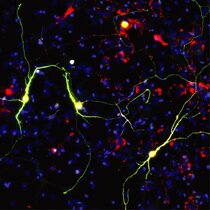 Reprogrammierte Neuronen bei Expression des proneuralen Faktors Ascl1 und neuronale mitochondriale Proteine 