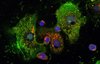 Humane Makrophagen mit immunregulierendem Peptid Pep19-2.5 (grün) und Färbung der ‚dispersed Transgolgi Netzwerk Membran‘ (rot).