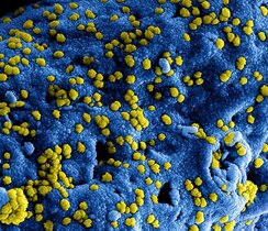 MERS-Coronaviruspartikel (gelb gefärbt) im Elektronenmikroskop