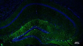Die Abbildung zeigt den Teil des Hippocampus einer Maus, der beim Erlernen der neuen Aufgabe aktiviert wird. In grüner Farbe erscheinen die Neuronen, die die spezifische Erinnerung an diese Aufgabe codieren.