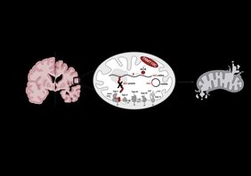 Erhöhte TRMT10C-Proteinspiegel bei Alzheimer-Demenz führen zu einer Methylierung der mitochondrialen mRNA