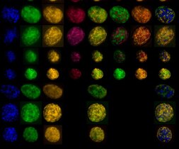 Bilder der fluoreszierenden in-situ Hybridisierung einer eingefärbten Achromatium oxaliferum Zelle. 