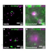 Vergleich der herkömmlichen mikroskopischen Aufnahmen (rechts) mit der neuen Bildgebungstechnik (links) 