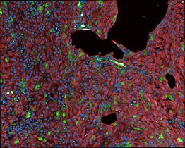 Der Algorithmus LSD hebt die Lungenzellen, die auf die Infektion reagieren, grün hervor. 