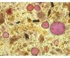 Aufbereitete Pollenprobe aus der Jungsteinzeit von den Sedimenten des Hüttwilersees. Pollenkörner sind rötlich eingefärbt. Holzkohleteilchen als Anzeichen für Brände erscheinen schwarz.  