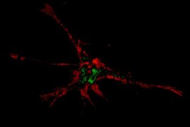 Magnetisch fanden die Nanopartikel ihren Weg in die Spitzen der Fortsätze von Nervenzellen.