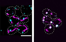 Ein Protein, zwei Einsatzorte (rechtes Bild): Wie Leuchtfarbstoffe sichtbar machen, befindet sich das Protein Ptc5 (magenta) nicht bloß in den Mitochondrien von Hefezellen (gestrichelt umrandet), sondern auch in den Peroxisomen, wo die Fluoreszenz durch Überlagerung weiß erscheint. Entfernt man das peroxisomale Transportsignal aus dem Protein, gelangt dieses nicht in das Organell (links).