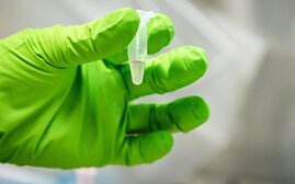 Eine Hand hält eine Abwasserprobe vor der Sequenzierung. 