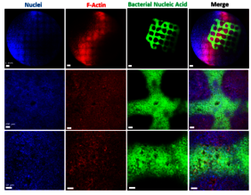 Biofilme auf humane Lungenzellen 3D