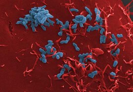 Adhäsion von Bartonella henselae