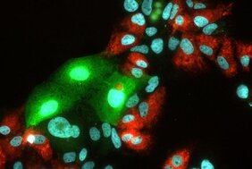 Hepatitis C virus (HCV) und Hepatitis E Virus (HEV) in humanen Leberzellen