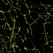 Schlucken Neuronen