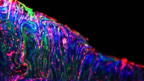 Mikroorganismen leben gerne in Biofilmen. 