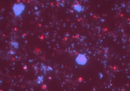 Mikroskopische Aufnahme einer gemeinsamen Kultur der beiden Bakterienarten. Die blaue Färbung zeigt alle Bakterien, bei den roten Punkten handelt es sich um Viren.