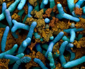 Knöllchenbakterien (blau) in einer Pflanzenwurzel. Braun sichtbar sind pflanzliche Proteine (kolorierte elektronenmikroskopische Aufnahme).