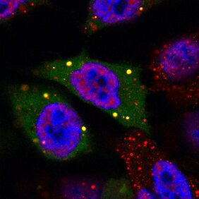 Das regulatorische Protein 4E-T (grün) unter dem Mikroskop mit Fluoreszenzfarbstoffen sichtbar gemacht. 