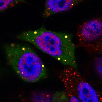 Das regulatorische Protein 4E-T (grün) unter dem Mikroskop mit Fluoreszenzfarbstoffen sichtbar gemacht. 