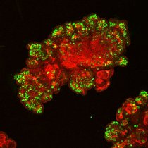 Das Bild zeigt eine mikroskopische Aufnahme von einem menschlichen Darm-Organoid