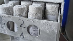 Probengefäße in der Tiefkühlung