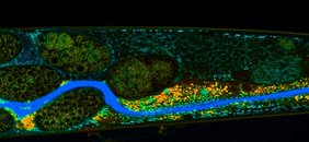 Verdauungstrakt von C. elegans