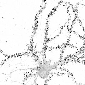 Verfolgung der Echtzeit-Dynamik der Protein-Synthese für endogene Proteine in lebenden Neuronen.