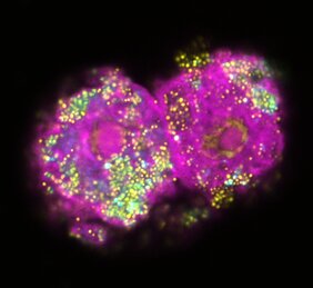Das fluoreszenzmikroskopische Bild zeigt zwei Amöbenzellen in pink, die mit Parachlamydien (gelb/blau), die in der Umwelt weit verbreitet sind, infiziert sind