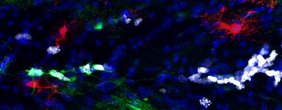 Proliferative Astrozyten in der weißen Substanz des murinen Gehirns.