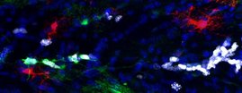 Proliferative Astrozyten in der weißen Substanz des murinen Gehirns.