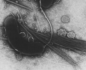 Vibrio cholerae (TEM-Aufnahme)
