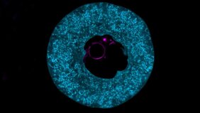 Eine Eizelle einer Maus, die mit dem Protein PADI6 (blau) gefüllt ist