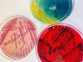 Wachstum von Bakterienkulturen in Petrischalen