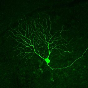Winzige anatomische Details einer Nervenzelle können ihr Signalverhalten entscheidend beeinflussen.