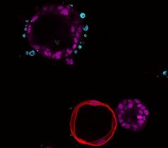 Das Fluoreszenzbild zeigt Organoide (Zellkerne in lila) in Ko-Kultur mit T-Zellen (blau).