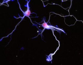 Immunostaining von kultivierten Neuronen (rot: Zellkern; weiß: Tubulin, blau: Aktin) 