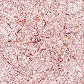 Graphen stellen Verbindungen zwischen Genomen als Knotenpunkte dar. Weichen Gene eines Organismus stark von typischen Genen seiner Spezies ab, werden sie als auffällige Kurven und Linien dargestellt.