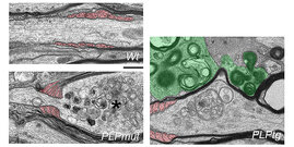Elektronenmikroskopische Aufnahmen von Axonen in der weißen Substanz von gesunden Kontroll-Mäusen (links oben) und von Mäusen mit verschiedenen Myelin-Gendefekten.