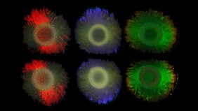 Zwei Reihen von je drei Kolonien des Meeresbakteriums Marinobacter alginolytica. Links rot gefärbt, mitte grün, rechts blau.