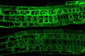 PILS6- Proteine (grün) in der Wurzelspitze