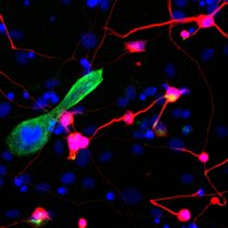 Pionier-Faktoren machen’s möglich: In der Kulturschale umprogrammierte Bindegewebszellen werden zu Nervenzellen (rot) und Muskelzellen (grün).
