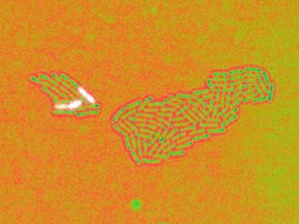 Zellen von Pseudomonas aeruginosa in Falschfarben dargestellt.