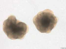 Zwei kortikale Organoide der Maus nach 13 Tagen in Kultur. Zwei kortikale Organoide der Maus nach 13 Tagen in Kultur.