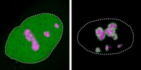 Proteintröpfchen als Ursache vieler genetischer Krankheiten