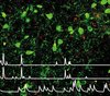 Leptin-sensitive Neuronen im lateralen Hypothalamus 
