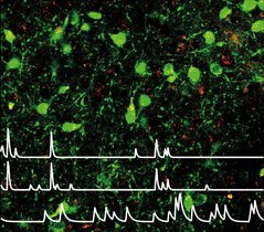 Leptin-sensitive Neuronen im lateralen Hypothalamus 