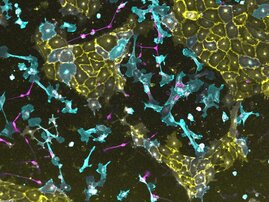 Drei transgene iPS-Linien, in denen jeweils ein anderer Transkriptionsfaktor aktivierbar ist, wurden gemischt und zu einem synthetischen Gewebe innerhalb von vier Tagen induziert. 