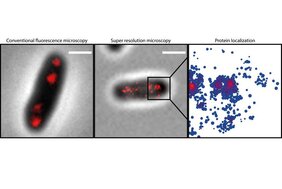 Proteinlokalisation in Einzelzellen von Corynebacterium glutamicum: Das rot markierte Protein ParB in einer Bakterienzelle (links); mit Hilfe von höchstauflösender Mikroskopie werden Einzelstrukturen in den ParB Ansammlungen sichtbar (Mitte)