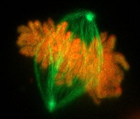 Das Zinkfingerprotein ZNF512B während der Teilung (Mitose) einer menschlichen Zelle Das Zinkfingerprotein ZNF512B während der Teilung (Mitose) einer menschlichen Zelle