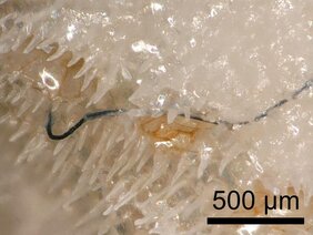 Die Aufnahme im Digitalmikroskop offenbart: eine Dornenkronenkoralle (Seriatopora hystrix) hat eine Faser in ihr Kalkskelett eingebaut  